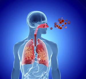 HYALURONAN SERVES A NOVEL ROLE IN AIRWAY MUCOSAL HOST DEFENSE 